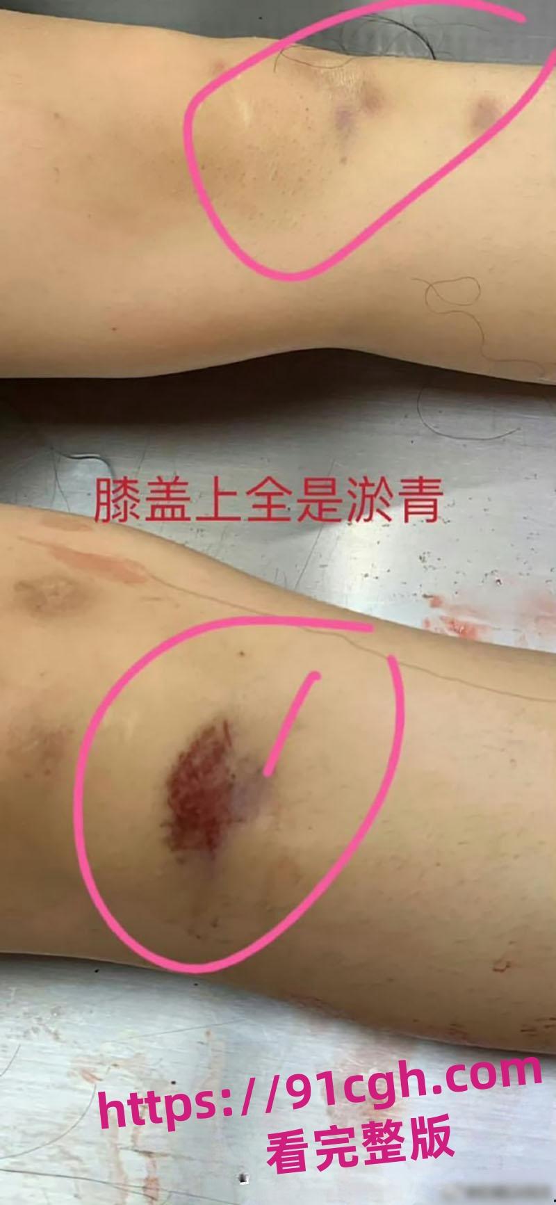 辽宁大连普兰店女孩 徐园 事件再起波澜 男子家中砍死女友 却被无罪释放！-6